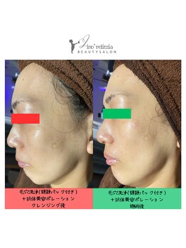 リノレリチア 心斎橋 新町店/