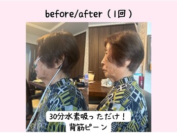 ヨサパーク ベアトリーチェ(YOSA PARK beatrice)/水素吸入だけで姿勢改善？！