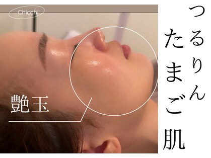 チッチ(Chicchi)の写真