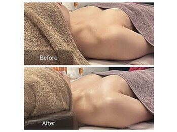 ベンザイ 新潟店(BENZAI)/巻肩とバストが崩れる