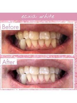 エクシアホワイト 長野店/