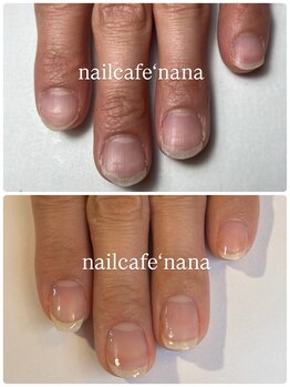 ネイルカフェ ナナ(nailcafe'nana)/自爪育成