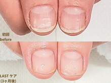 ナユネイル(na_yu.nail)/地爪育成｜お悩み改善