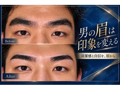 リジュベ(Rejuve)の写真