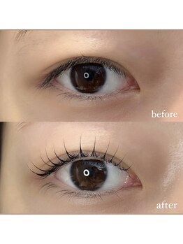 ビス(Bis)/ラッシュカール♪