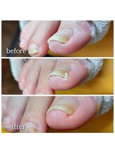 爪切り屋 足楽/