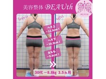 ビュース(BEAUth)の雰囲気（30代／ー8.8kg／おへそ下ー10.9cm／太ももー9.8cm／3.5ヶ月）