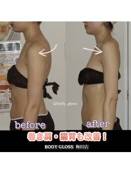 ボディグロス 梅田店(BODY GLOSS)/巻き肩、猫背も改善して美姿勢に