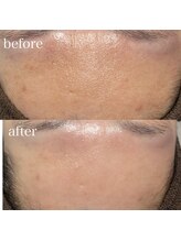 薫風/フェイシャルワックス／30代