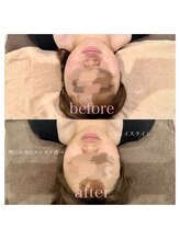 ライム 松本(LIME)/《Hi-UP＊フェイスライン改造》