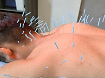 テイクケア(TAKEケア)の写真/《整体マッサージ＋鍼灸で根本改善》他のお店だと物足りないと感じるメンズの方は必見◎強もみも得意です！