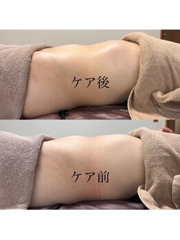 ソフ 津店(SOFS)/ぽっこりお腹改善