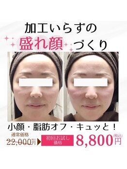 ラシク 横浜店(Rasik)の写真/【口コミ4.9◎ 写り激変！速攻×持続の小顔ケア】
加工いらずの“盛れ顔”は、ここでつくる。