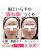 ラシク 横浜店(Rasik)の写真/【口コミ4.9◎ 写り激変！速攻×持続の小顔ケア】
加工いらずの“盛れ顔”は、ここでつくる。