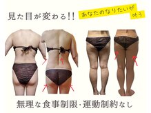 ヨサパーク リノ(YOSA PARK Lino)