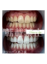 ホワイトニングサロン 札幌店/【ホワイトニング】#札幌#大通り