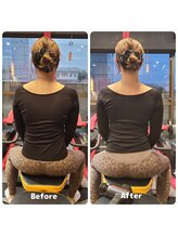 ピーチ(Peach)/筋膜リリース Before＆After