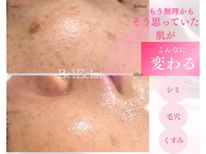 ベルエクラ(Bel Eclat)の写真