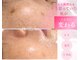 ベルエクラ(Bel Eclat)の写真