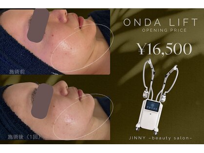 ジーニー(JINNY)の写真