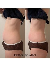 スターエステ(STAR ESTHE)/