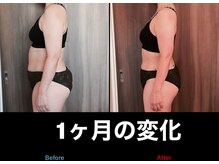 カオン(Kaon)/美容矯正ダイエット