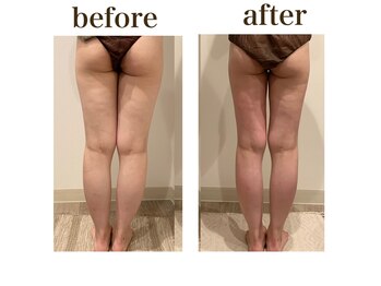 ルアバイアロ(Lua by Alo's)/下半身集中コース