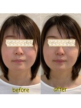 ピエール ナリタイラボ(Piel NARITAI LABO)/小顔整体