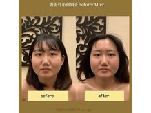 アジール 新潟市(agir)/Before/After画像