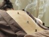 【自律神経改善】　鍼灸施術　約80分（カウンセリング込み）　¥8250→7500