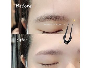 ビオラス 天王寺2号店(Biolus)/【眉毛/まゆげ】Before/After