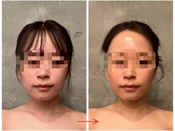 ビノワ(Binowa)/キュッと引き締まった印象★