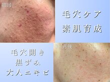 リブ(LIB)の雰囲気（【毛穴洗浄+美白エステ】毛穴開き,黒ずみ,大人ニキビに◎）