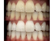 プロテア 藤枝店(PROTEA)/医療提携.セルフホワイトニング