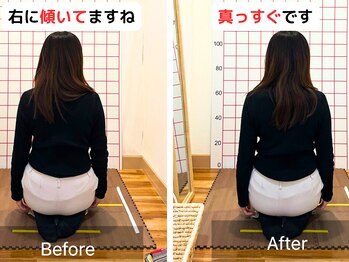 よしかわ整体院/右に傾く重心のズレ