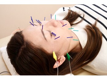 寝屋川鍼灸整骨院/美容鍼