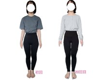 フォーシー(4C)/Before/After