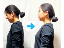 いのくち接骨院/姿勢改善の症例