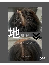 ネムリビト/頭皮は髪の土台