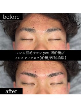 ユー 西船橋店(you)/ビフォーアフター写真