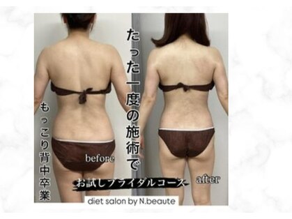 エヌボーテ(N. beaute)の写真