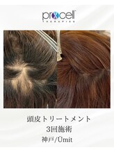 ユミト(Umit)/プロセルスカルプ