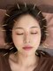 ケイ美容鍼灸整体院(KEI美容鍼灸整体院)の写真/船橋駅近く、女性鍼灸師の美容鍼でリフトアップや美肌へ。肩こり腰痛もサポート♪