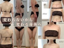 レスプロンディール(Resplendir)