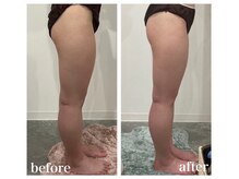 ファビリス 仙台ロフト店(FAVILIS)/【痩身】キャビリポ痩身60分4回