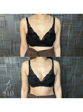 ジュリア(JULIA)/【バストアップ/育乳　症例】