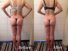 ジェイオー(J.O)/痩身コルギ/美脚コルギ/リンパ