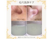 クレア 国際通りカーゴス店(CREA)の雰囲気（毛穴洗浄/お顔/頭皮/スッキリ/すべ肌／美肌リラックス/癒し☆）