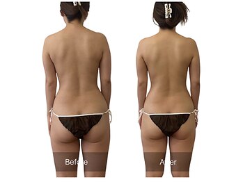 ベンザイ 梅田店(BENZAI)/巻肩、肩こり、片頭痛