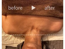 チャームズ(CHARM'S)/メンズパワーツリー★